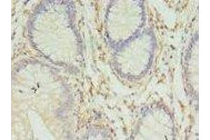 Image no. 3 for anti-Major Histocompatibility Complex, Class II, DR beta 4 (HLA-DRB4) (AA 30-227) antibody (ABIN6060855)