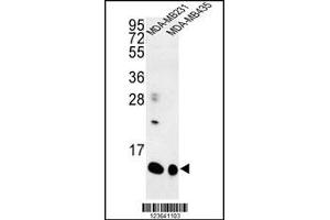 Image no. 1 for anti-Small Proline Rich Protein 1B (SPRR1B) (C-Term) antibody (ABIN2503535)