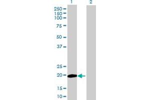 Image no. 1 for anti-Zinc Finger, C3HC-Type Containing 13 (ZCCHC13) (AA 1-166) antibody (ABIN531766)