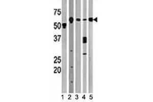 Image no. 2 for anti-Beclin 1, Autophagy Related (BECN1) (AA 210-239) antibody (ABIN3030156)