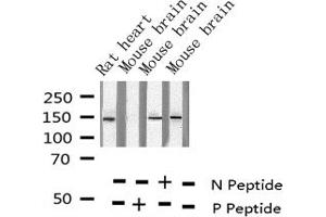 Image no. 1 for anti-Met Proto-Oncogene (MET) (pTyr1349) antibody (ABIN6255803)