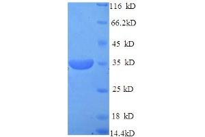 SDS-PAGE (SDS) image for Pituitary Homeobox 3 (PITX3) (AA 1-302), (full length) protein (His tag) (ABIN5713730)
