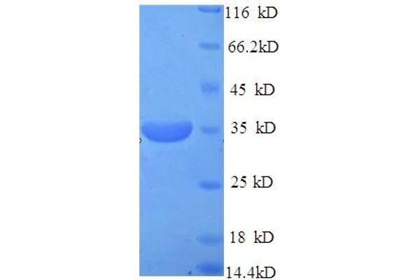 PITX3 Protein (AA 1-302, full length) (His tag)