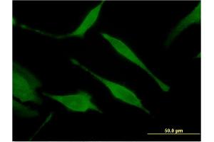 Image no. 1 for anti-Histidine Triad Nucleotide Binding Protein 1 (HINT1) (AA 1-126) antibody (ABIN516453)
