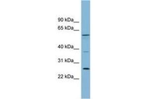 Image no. 1 for anti-Ganglioside-Induced Differentiation-Associated-Protein 2 (GDAP2) (AA 143-192) antibody (ABIN6742148)