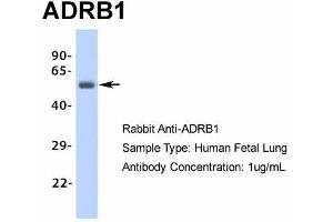 Image no. 3 for anti-Adrenergic, beta-1-, Receptor (ADRB1) (Middle Region) antibody (ABIN2774823)