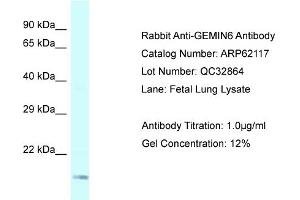 Image no. 1 for anti-Gem (Nuclear Organelle) Associated Protein 6 (GEMIN6) (Middle Region) antibody (ABIN2789026)