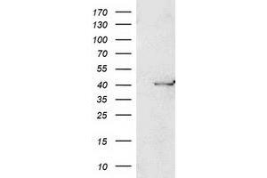 Image no. 4 for anti-Paraoxonase 1 (PON1) antibody (ABIN1500347)