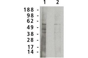 Image no. 1 for anti-Sphingomyelin phosphodiesterase 1, Acid Lysosomal (SMPD1) antibody (ABIN306944)