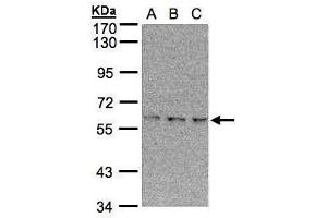 Image no. 1 for anti-EPM2A (Laforin) Interacting Protein 1 (EPM2AIP1) (N-Term) antibody (ABIN2856551)