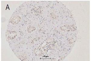 Immunohistochemistry (IHC) image for anti-Tight Junction Protein 1 (TJP1) (AA 1551-1702) antibody (ABIN675024)