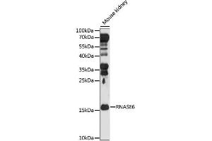 Image no. 1 for anti-Ribonuclease, RNase A Family, K6 (RNASE6) antibody (ABIN6568642)