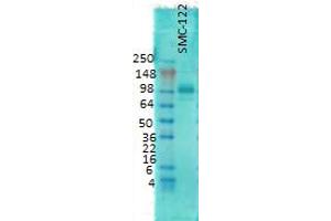 Western Blotting (WB) image for anti-Discs, Large Homolog 4 (Drosophila) (DLG4) antibody (ABIN361694)