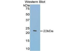 Western Blotting (WB) image for anti-TAF12 RNA Polymerase II, TATA Box Binding Protein (TBP)-Associated Factor, 20kDa (TAF12) (AA 1-161) antibody (ABIN1860675)