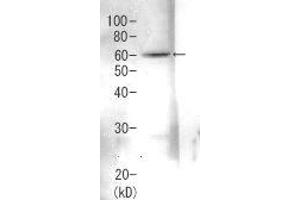 Image no. 1 for anti-Proteasome (Prosome, Macropain) 26S Subunit, Non-ATPase, 3 (PSMD3) antibody (ABIN2452113)