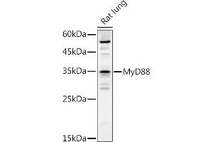 Western blot analysis of extracts of Rat lung, using MyD88 antibody (ABIN6128257, ABIN6144228, ABIN6144229 and ABIN6213986) at 1:1000 dilution.