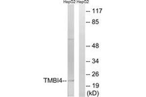 Image no. 1 for anti-Transmembrane BAX Inhibitor Motif Containing 4 (TMBIM4) (AA 121-170) antibody (ABIN1535425)