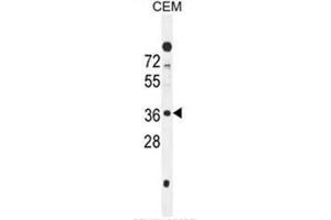 Image no. 2 for anti-SWI5-Dependent Recombination Repair 1 (SFR1) (AA 1-30), (N-Term) antibody (ABIN950712)