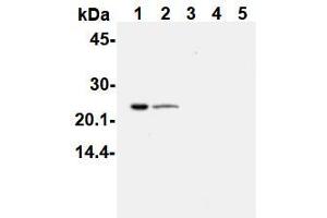 Image no. 1 for anti-PYD and CARD Domain Containing (PYCARD) antibody (ABIN1105662)