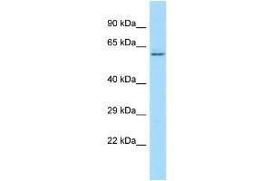 Image no. 1 for anti-Interleukin 17 Receptor D (IL17RD) (C-Term) antibody (ABIN2788937)