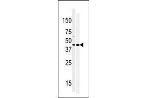 Image no. 1 for anti-Moloney Sarcoma Oncogene (MOS) (N-Term) antibody (ABIN360532)