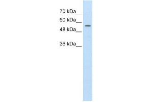 Image no. 1 for anti-ATP-Binding Cassette, Sub-Family D (Ald), Member 4 (ABCD4) antibody (ABIN630357)