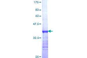 Image no. 1 for Dedicator of Cytokinesis 1 (DOCK1) (AA 698-803) protein (GST tag) (ABIN1351887)