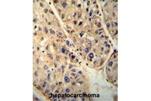 Image no. 2 for anti-ATP-Binding Cassette, Sub-Family D (Ald), Member 1 (ABCD1) (AA 264-293), (Middle Region) antibody (ABIN950202)