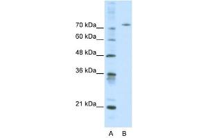 Image no. 1 for anti-Afamin (AFM) (Middle Region) antibody (ABIN633872)