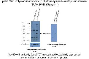 Image no. 1 for anti-Suppressor of Variegation 4-20 Homolog 1 (SUV420H1) antibody (ABIN1514984)