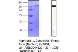 Nephrin Protein (AA 23-1055) (His tag)