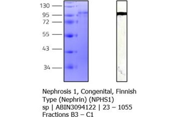Nephrin Protein (AA 23-1055) (His tag)