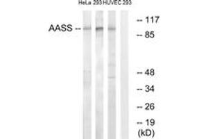Image no. 1 for anti-Aminoadipate Semialdehyde Synthase (AASS) (AA 251-300) antibody (ABIN1534623)