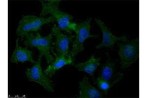 Immunofluorescence microscopy of Rabbit Anti-Beta Amyloid antibody using HeLa cells fixed with MeOH.