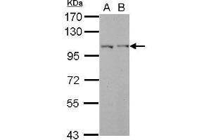 Image no. 2 for anti-PHD Finger Protein 17 (PHF17) (C-Term) antibody (ABIN2856437)