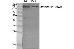Image no. 2 for anti-Inositol Polyphosphate-5-Phosphatase, 145kDa (INPP5D) (pTyr1021) antibody (ABIN3182231)