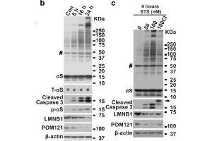 Image no. 7 for anti-POM121 Membrane Glycoprotein (POM121) (N-Term) antibody (ABIN2855297)