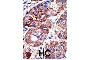 SQSTM1 antibody  (AA 317-346)