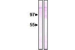 Western Blotting (WB) image for anti-Nucleoporin 153kDa (NUP153) (AA 610-1191) antibody (ABIN2452062)
