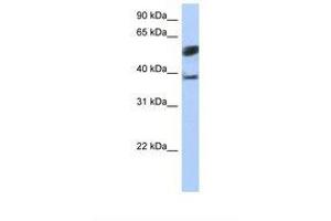 Image no. 1 for anti-Speckle-Type POZ Protein-Like (SPOPL) (AA 74-123) antibody (ABIN6739277)