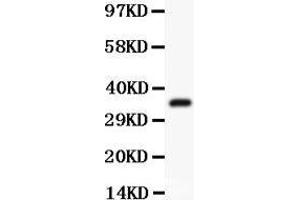 Image no. 1 for anti-Activating Transcription Factor 1 (AFT1) (AA 1-271) antibody (ABIN3043723)