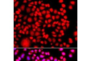 Immunofluorescence analysis of A549 cells using TESK2 Polyclonal Antibody