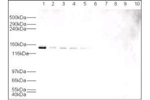 Western blot using  affinity purified anti-HAUSP antibody shows detection of HAUSP in various cell lysates at 130 kDa (lane 1 - HeLa nuclear extract, lane 2 - HeLa, Lane 3 - A431, Lane 4 - MCF7, Lane 5 - 3T3).