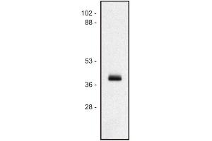 Image no. 1 for anti-MHC Class I Polypeptide-Related Sequence A (MICA) antibody (PE) (ABIN192165)