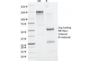 Image no. 1 for anti-CD163 (CD163) (AA 43-196) antibody (ABIN6941115)