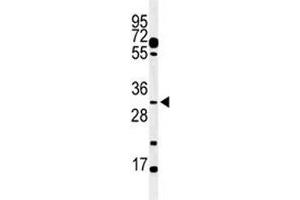 Image no. 1 for anti-Apolipoprotein B mRNA Editing Enzyme, Catalytic Polypeptide-Like 3B (APOBEC3B) (AA 299-330) antibody (ABIN3029993)