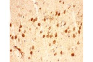 Image no. 2 for anti-Brain-Derived Neurotrophic Factor (BDNF) (AA 129-247) antibody (ABIN3030195)