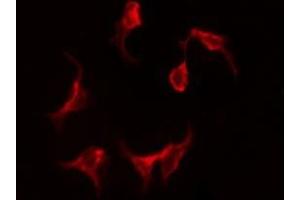 Image no. 1 for anti-Microsomal Glutathione S-Transferase 1 (MGST1) antibody (ABIN6257248)