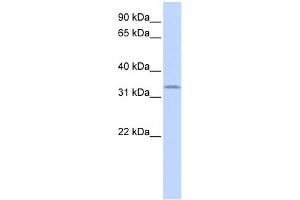 Image no. 1 for anti-SRY (Sex Determining Region Y)-Box 1 (SOX1) (Middle Region) antibody (ABIN2777427)