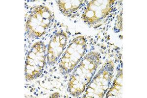 Immunohistochemistry of paraffin-embedded human colon using MyD88 Antibody (ABIN6128257, ABIN6144228, ABIN6144229 and ABIN6213986) at dilution of 1:100 (40x lens).